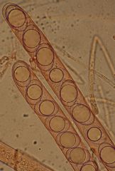 Helvella acetabulum-Ascas y ascosporas (Autor: Augusto Calzada)