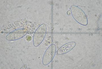 Plectania melastoma-ascosporas ( Autor: Augusto Calzada)